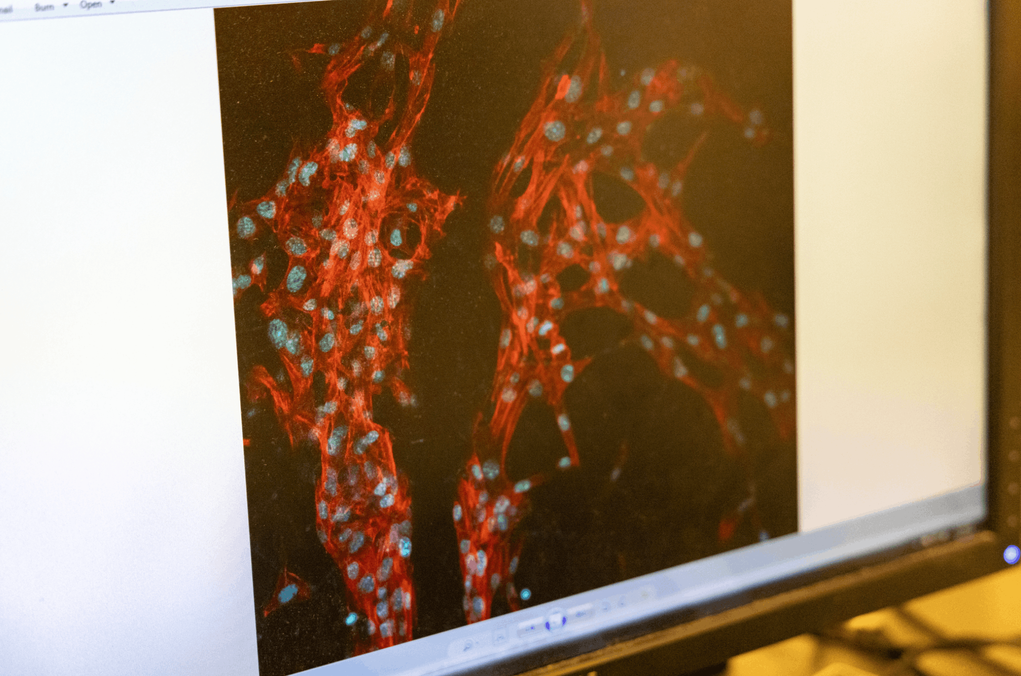Red and blue microscope image showing cells on a dark background.