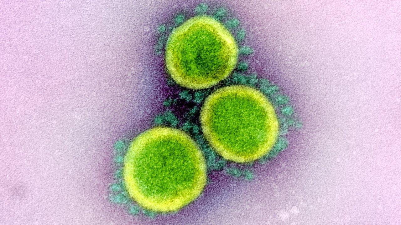 Photo: National Institute of Allergy and Infectious Diseases, National Institute of Health. uc davis biological agricultural engineering coronavirus gang sun
